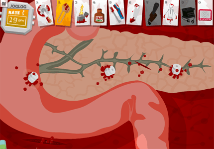 Amateur Surgeon - Bullets in the pancreas