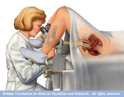 Colposcope used to examine the cervix
