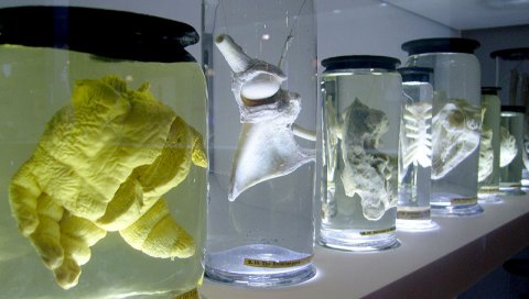 Specimen from William Hunter's pathological collection on display.