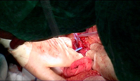 Heads in the way It never ends