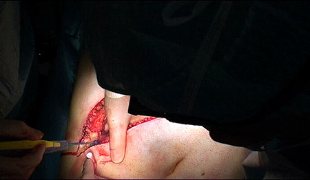 Heads in the way More heads