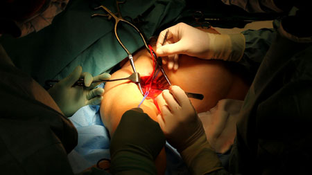 ilp_mkii_1_450 Video still. Click for full size image.