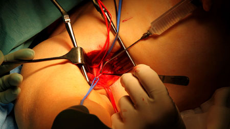 ilp_mkii_2_450 Closer shot of the same area. Click for full size image.